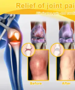 ADNOON™ Botulinum Toxin & Bee Venom Pain-Relief Bone Healing Cream
