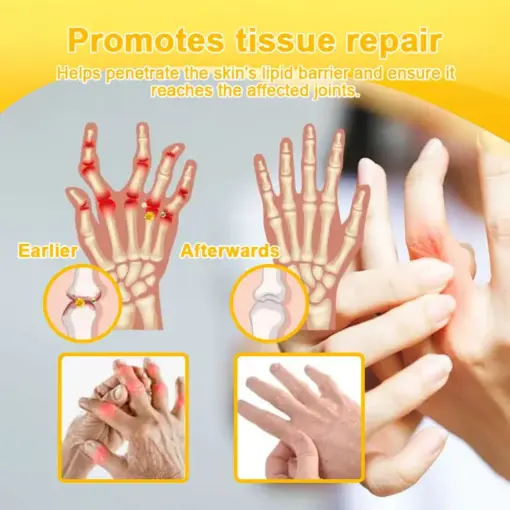 ADNOON™ Botulinum Toxin & Bee Venom Pain-Relief Bone Healing Cream