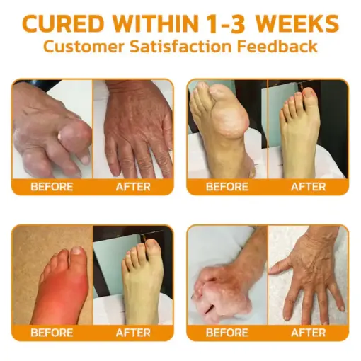 ADNOON® Magnesium Oil & Bee Venom Pain-Relief Bone Healing Cream