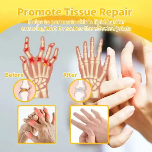 ADNOON® Magnesium Oil & Bee Venom Pain-Relief Bone Healing Cream