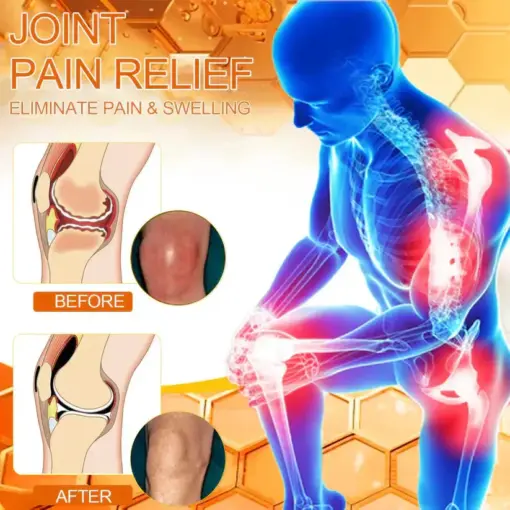 ADNOON® Magnesium Oil & Bee Venom Pain-Relief Bone Healing Cream