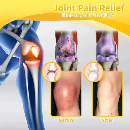 ADNOON® Magnesium Oil & Bee Venom Pain-Relief Bone Healing Cream
